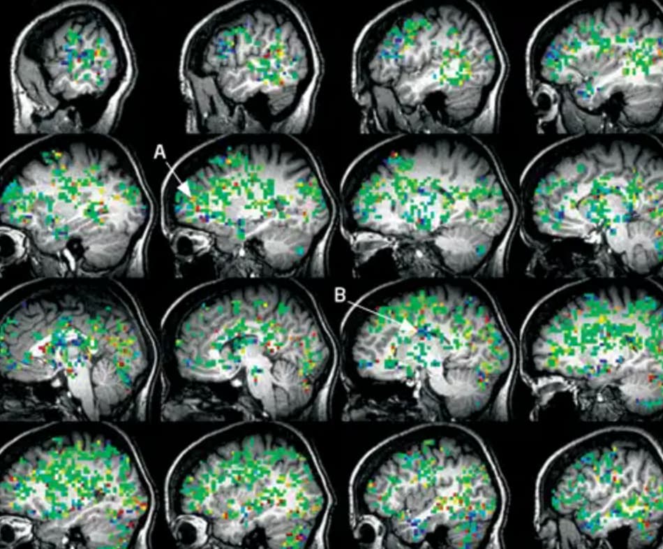 male brain during - A B